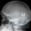 a volte vorrei avere un piccolo iChip MacOS intracraniale/intragangliare per poter dare un layout a certi pensieri…